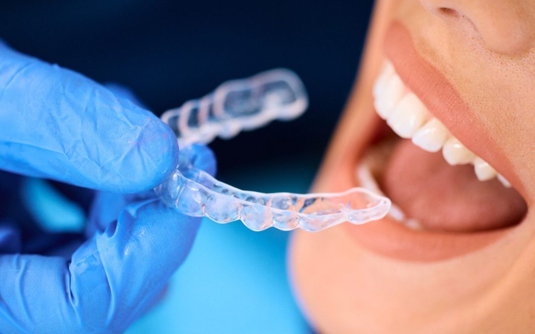 Invisalign vs Braces: Costs, Advantages, and Disadvantages